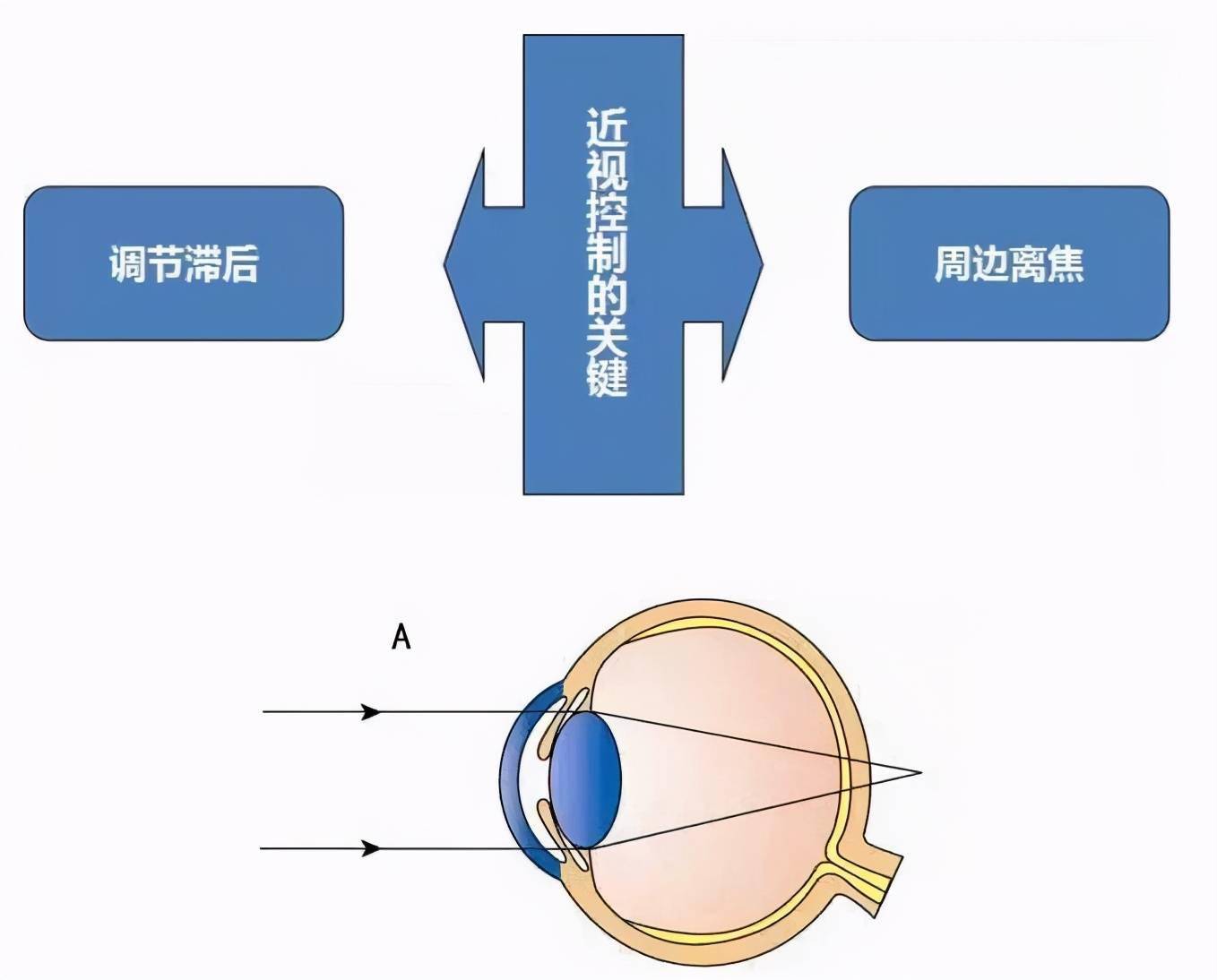 锗镜片价格